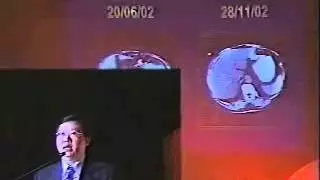 Dr. Sui Chai aus Thailand - Anti-Krebs-Konferenz